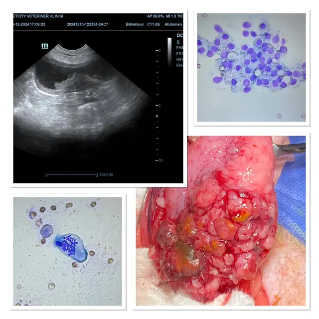 Transisyonel Hücreli Karsinom Vakası