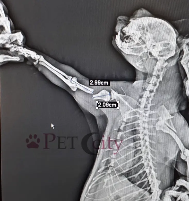 Bilbo'nun Humerus Kırığı ve Başarılı Operasyonu